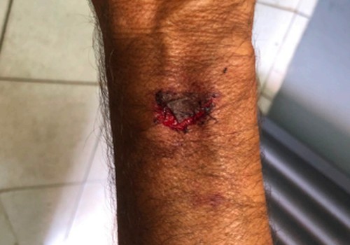 Homem é preso após agredir familiar durante confraternização na frente dos policiais e danificar viatura
