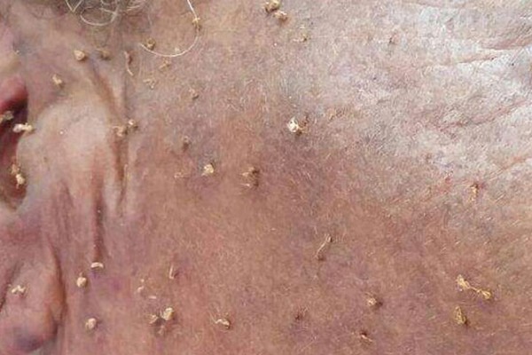 Idosa de 84 anos atacada por abelhas em Presidente Olegário morre no Hospital Regional