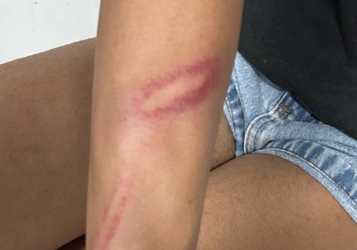 Marido e mulher trans se agridem com socos, tapas, mordidas e pauladas e os dois vão parar na Delegacia