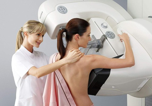 Mulheres poderão fazer mamografia em Patos de Minas sem agendamento