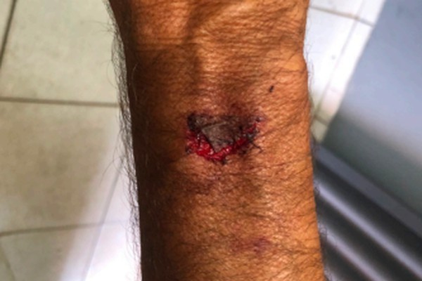 Homem é preso após agredir familiar durante confraternização na frente dos policiais e danificar viatura