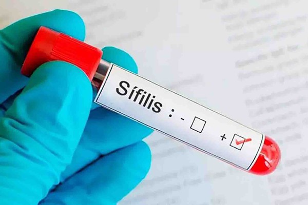 Aumento de casos de Sífilis em Patos de Minas preocupa a saúde; doença pode levar à morte