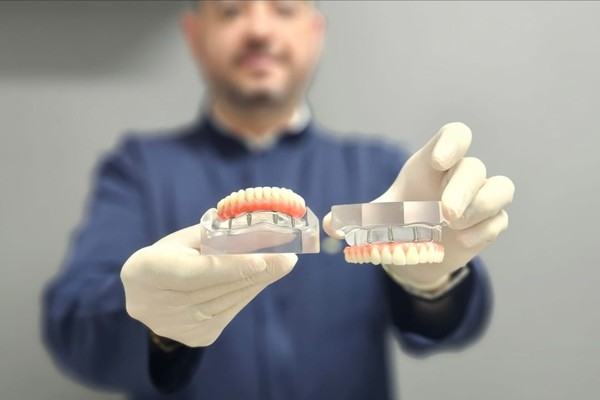 Implantes e Prótese Fixa Protocolo a valores e condições nunca vistos em Patos de Minas e Região