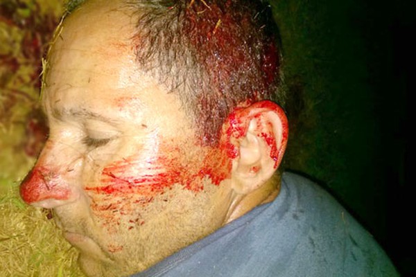 Assaltantes trocam tiros com a PM em Lagoa Formosa e um acaba preso ao ser atingido no braço