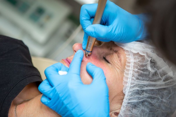 Clínica e esteticista devem indenizar cliente por uso de material errado para rejuvenescimento em MG