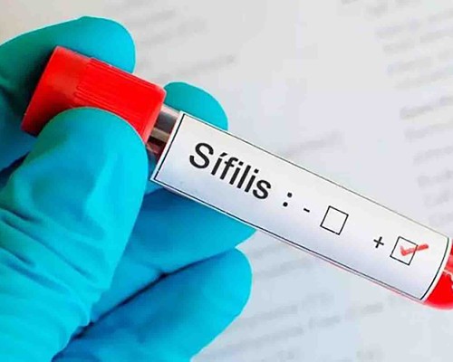 Aumento de casos de Sífilis em Patos de Minas preocupa a saúde; doença pode levar à morte