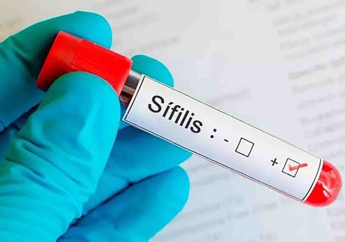 Aumento de casos de Sífilis em Patos de Minas preocupa a saúde; doença pode levar à morte