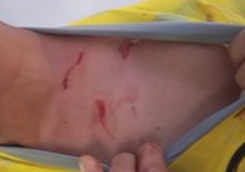 Homem é atacado com tesoura durante briga em barbearia e dois acabam presos em Patos de Minas