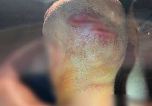 Homem é agredido com pedaço de madeira durante confraternização e fica desacordado, em Patos de Minas