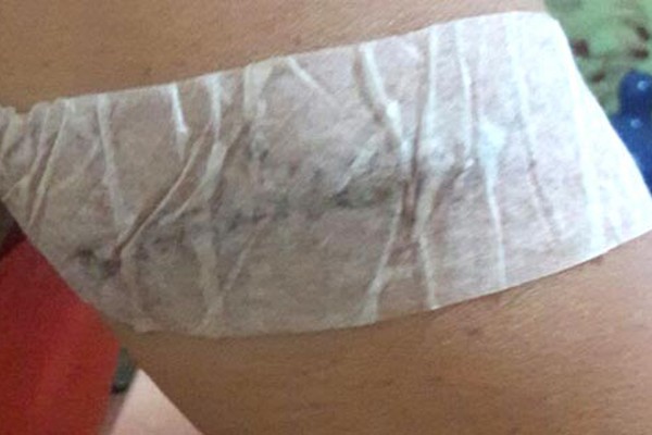 Mulher agredida a facadas na porta de casa diz que já vinha sendo incomodada pelo vizinho