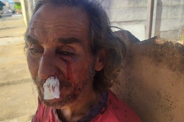 Homem é espancado dentro da própria casa em Patos de Minas; Polícia procura agressores