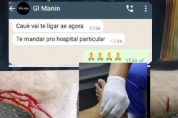 Cantor Marcelo Lima foi atacado por macaco e recebeu auxílio e zoação do irmão Gusttavo Lima