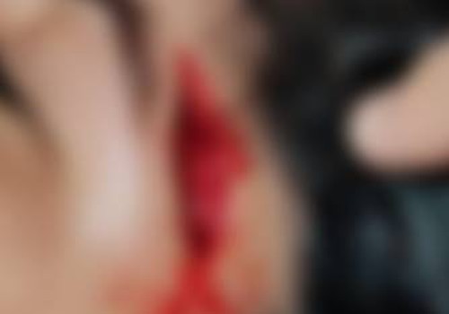 Jovem tenta apaziguar confusão, é agredida com capacetada e sofre grande corte na cabeça, em Patos de Minas